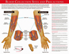 poster of the anatomy of the antecubital area