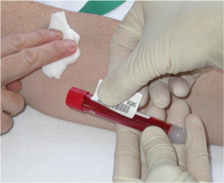 Labeling blood tube