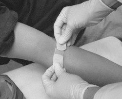 bandaging venipuncture site