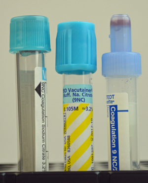 three unfilled blood tubes