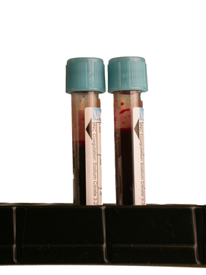 two blood collection tubes for coagulation testing