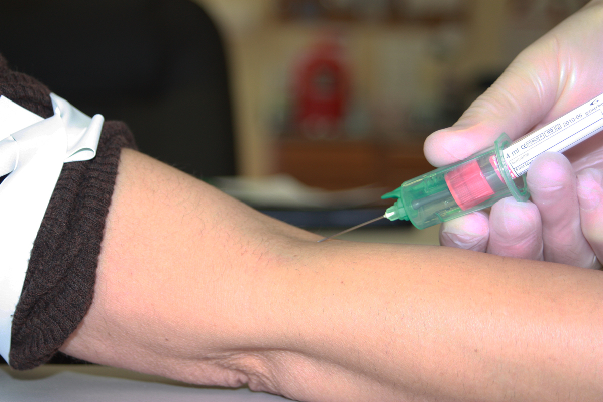 Blood draw angle of insertion for venipuncture